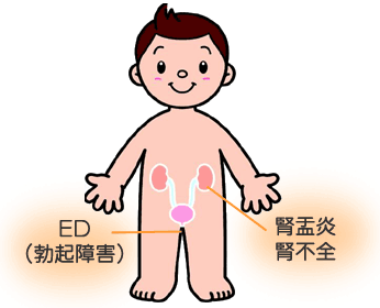 慢性合併症イメージ２